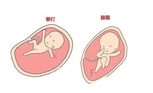 揭秘：广州第三代试管婴儿可以选性别？“包生男孩”是真还是假的？